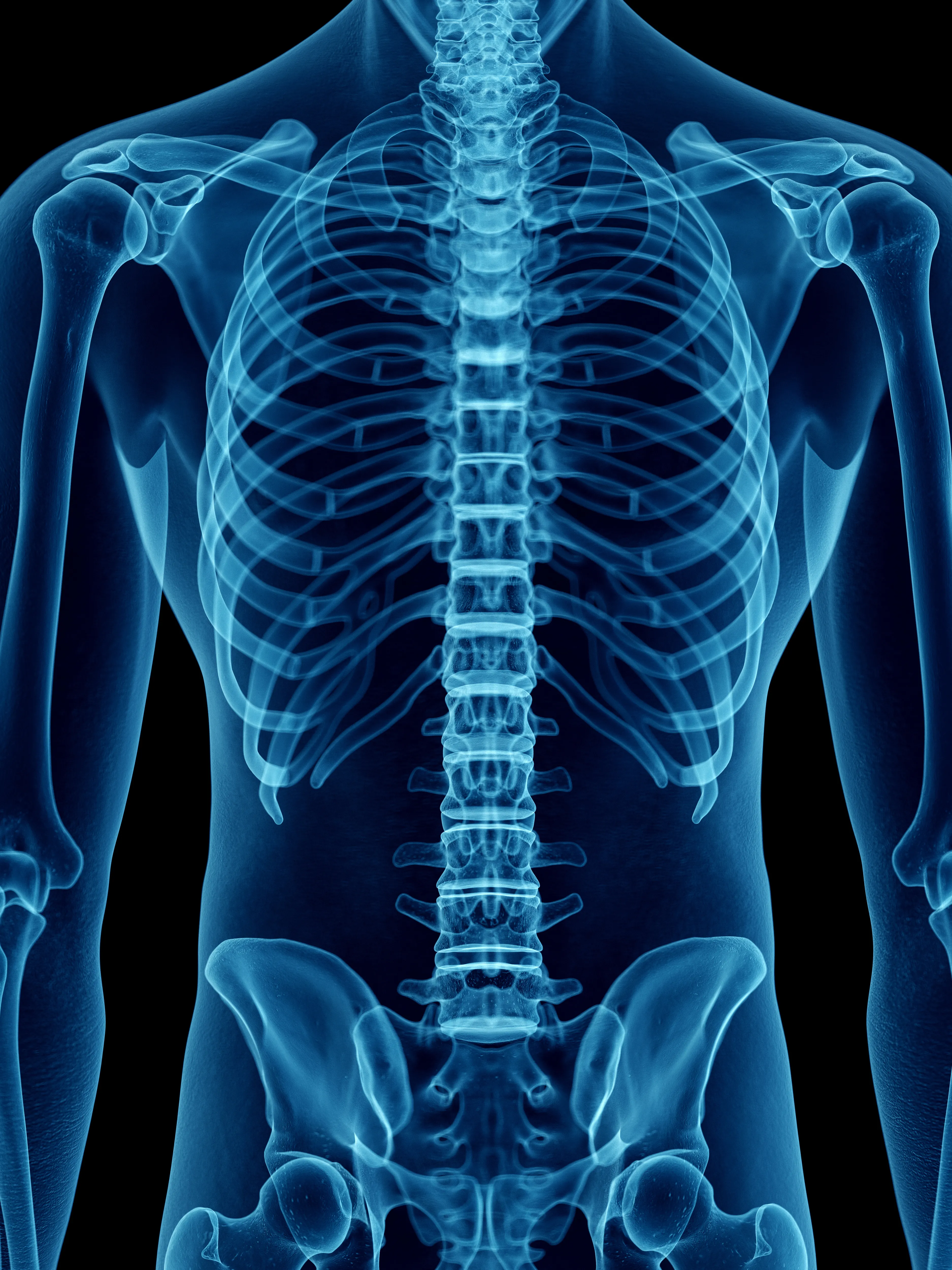 Une image de radiologie montrant les os du thorax, des épaules, des bras et ceux du bassin.